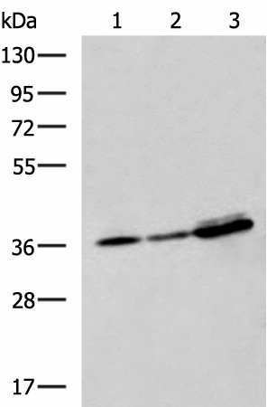 EEF1D Polyclonal Antibody (E-AB-19083)