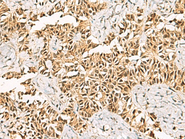 LRIF1 Polyclonal Antibody (E-AB-52491)
