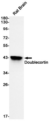 Recombinant Doublecortin Monoclonal Antibody (E-AB-81552)