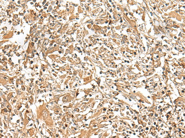 GEMIN4 Polyclonal Antibody (E-AB-17994)