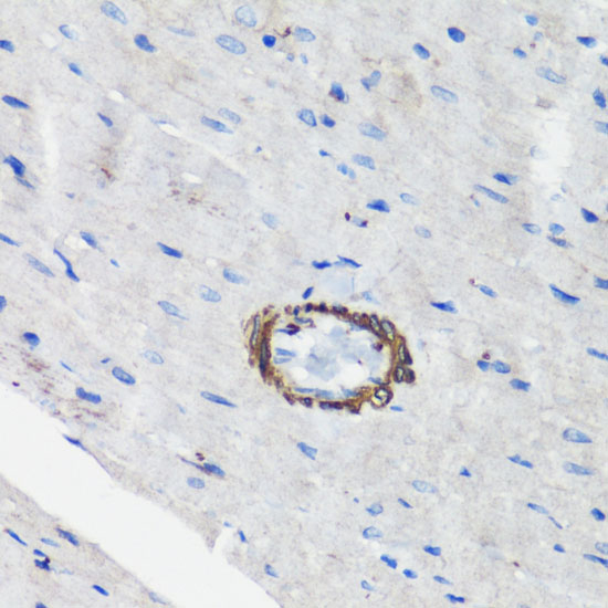 FLNA Polyclonal Antibody (E-AB-66787)