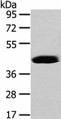 VASH2 Polyclonal Antibody (E-AB-17250)