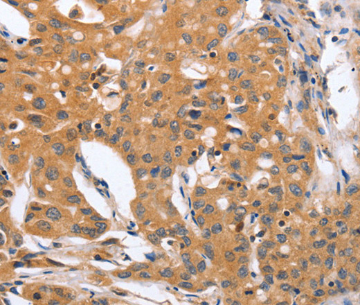 BLNK Polyclonal Antibody (E-AB-13091)