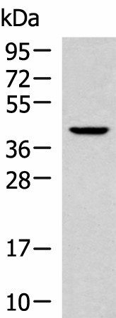KLF6 Polyclonal Antibody (E-AB-52129)