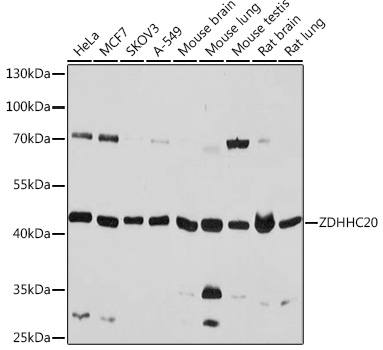 ZDHHC20 Polyclonal Antibody (E-AB-91968)
