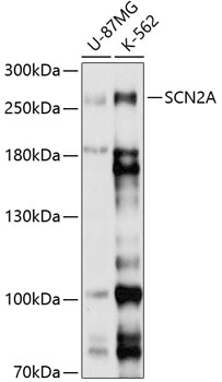 SCN2A Polyclonal Antibody (E-AB-90212)