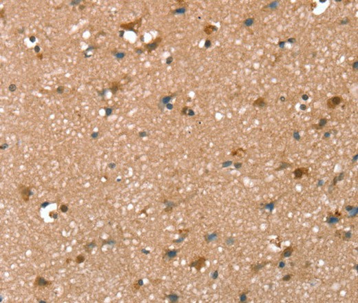 SYNPO2 Polyclonal Antibody (E-AB-16895)