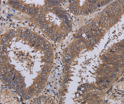 P3H3 Polyclonal Antibody (E-AB-15169)