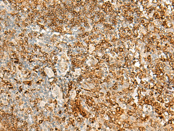 HLA-DRB1 Polyclonal Antibody (E-AB-18083)