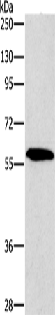 PAK2 Polyclonal Antibody (E-AB-14278)