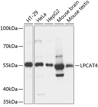 LPCAT4 Polyclonal Antibody (E-AB-90799)