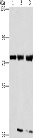 GGCX Polyclonal Antibody (E-AB-11264)