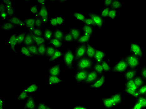 AFF1 Polyclonal Antibody (E-AB-61412)