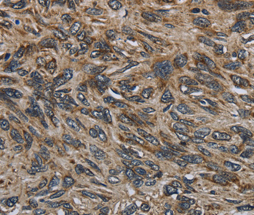 CD236 Polyclonal Antibody (E-AB-11277)