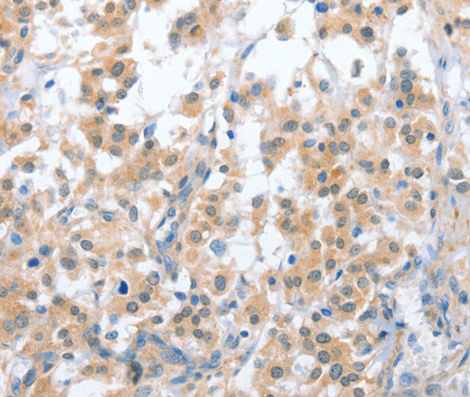 OX2R Polyclonal Antibody (E-AB-11049)