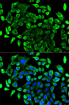 TAB1 Polyclonal Antibody (E-AB-67699)