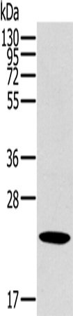 OTUB2 Polyclonal Antibody (E-AB-11462)