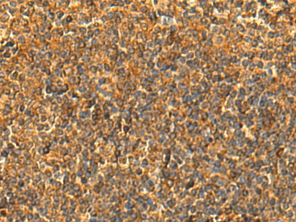 HS1BP3 Polyclonal Antibody (E-AB-18941)