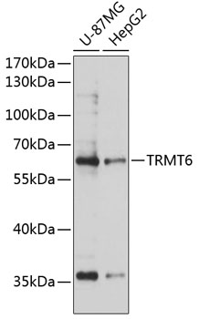 TRMT6 Polyclonal Antibody (E-AB-92943)