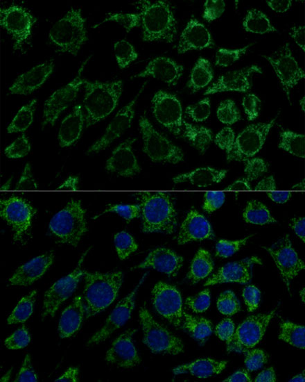 IDH3B Polyclonal Antibody (E-AB-64812)