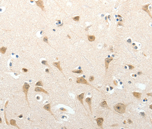 SEMA3D Polyclonal Antibody (E-AB-12867)