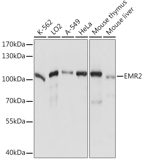 EMR2 Polyclonal Antibody (E-AB-90779)