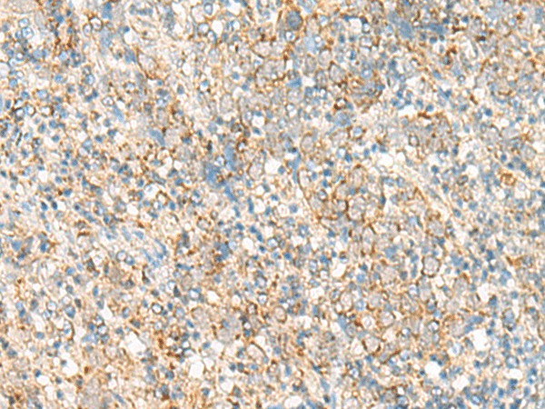 PSD4 Polyclonal Antibody (E-AB-52792)