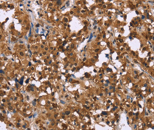 GPR171 Polyclonal Antibody (E-AB-16469)