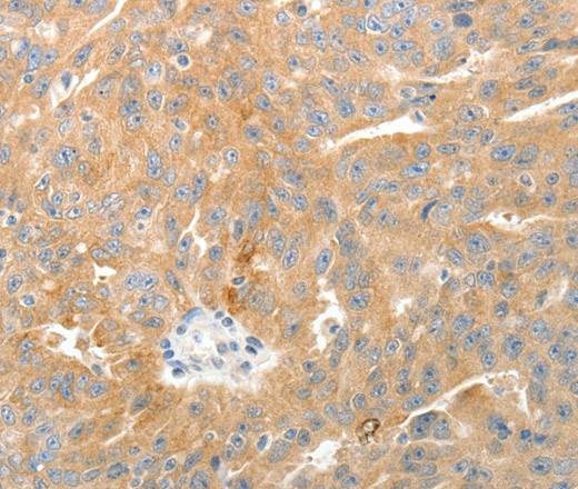 TEP1 Polyclonal Antibody (E-AB-12902)