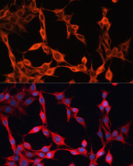 SLC25A23 Polyclonal Antibody (E-AB-66271)