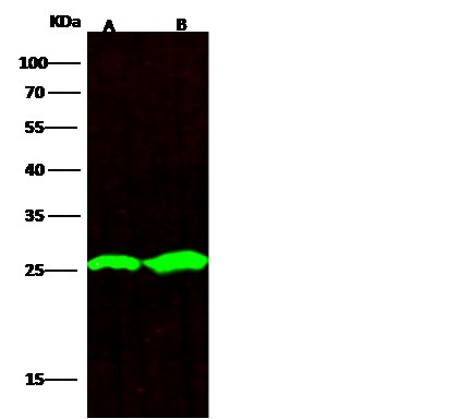 Recombinant UCHL1 Monoclonal Antibody (AN300585P)