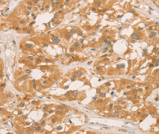 CPB1 Polyclonal Antibody (E-AB-11098)