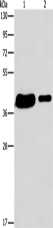 SAE1 Polyclonal Antibody (E-AB-10864)