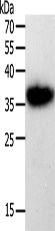 PLAUR Polyclonal Antibody (E-AB-10547)