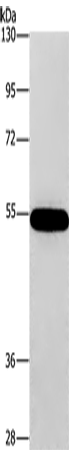 CNDP1 Polyclonal Antibody (E-AB-11091)