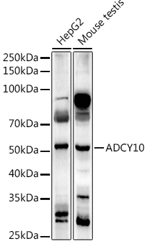 ADCY10 Polyclonal Antibody (E-AB-92063)