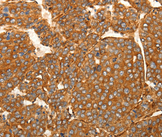 SFRP1 Polyclonal Antibody (E-AB-16059)