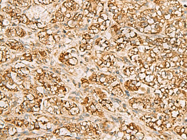 MTAP Polyclonal Antibody (E-AB-52694)