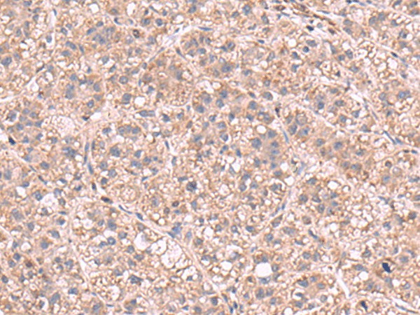 KPNA2 Polyclonal Antibody (E-AB-52984)