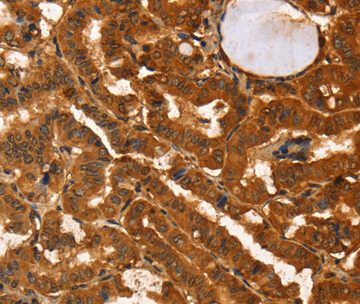 IKZF3 Polyclonal Antibody (E-AB-14763)