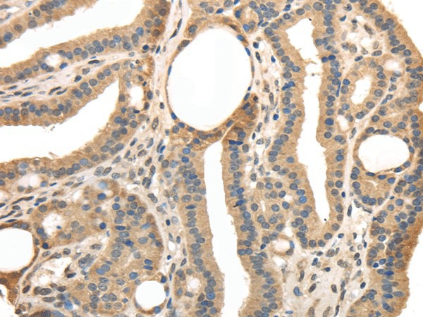 TRIB3 Polyclonal Antibody (E-AB-17150)