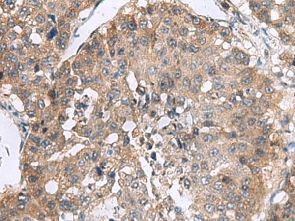 RPL18 Polyclonal Antibody (E-AB-19152)