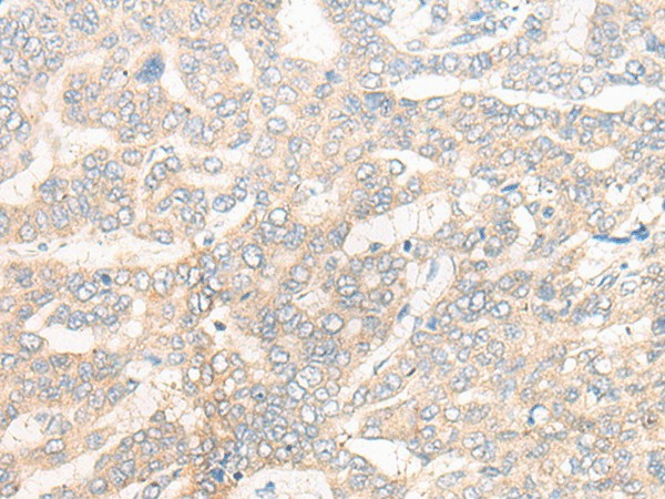 CYB5R3 Polyclonal Antibody (E-AB-19777)