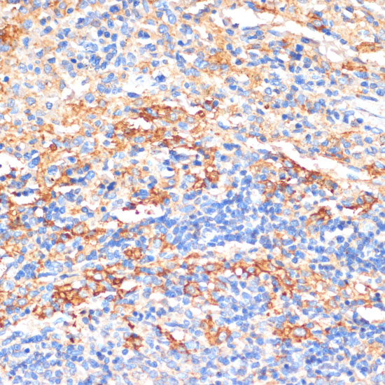 APCS Polyclonal Antibody (E-AB-67395)