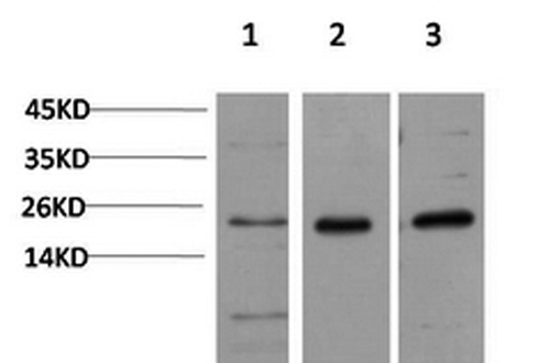 CBX5 Monoclonal Antibody (E-AB-22146)