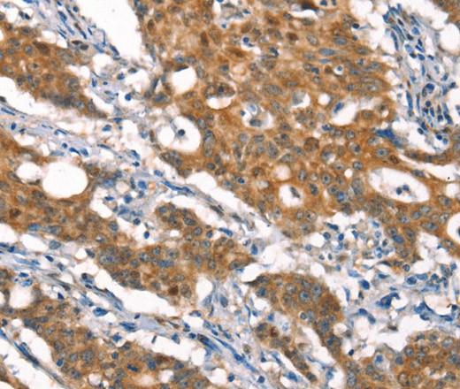 CYLD Polyclonal Antibody (E-AB-16369)