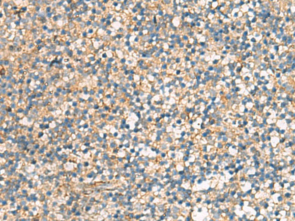 KIF2C Polyclonal Antibody (E-AB-18750)