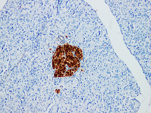 NSE Monoclonal Antibody (ELAB6914-M)