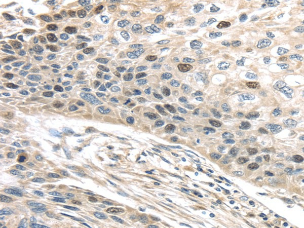 TPX2 Polyclonal Antibody (E-AB-17130)