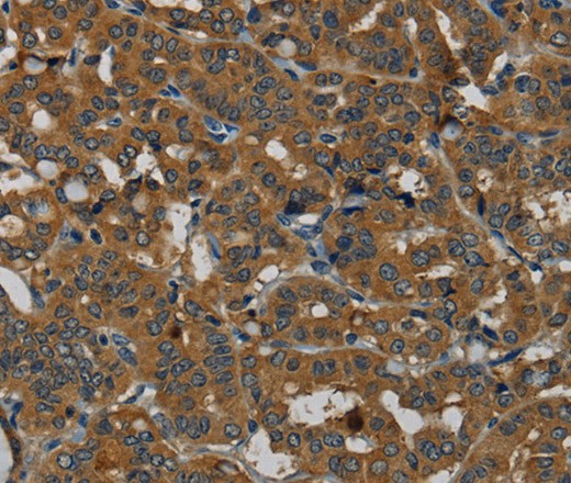 PDE5A Polyclonal Antibody (E-AB-16696)